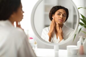 Upset Black Woman With Problem Skin Looking At Pimple On Chin